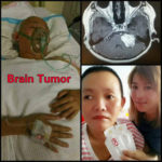 Soplus black seed oil d ribose brain tumor
